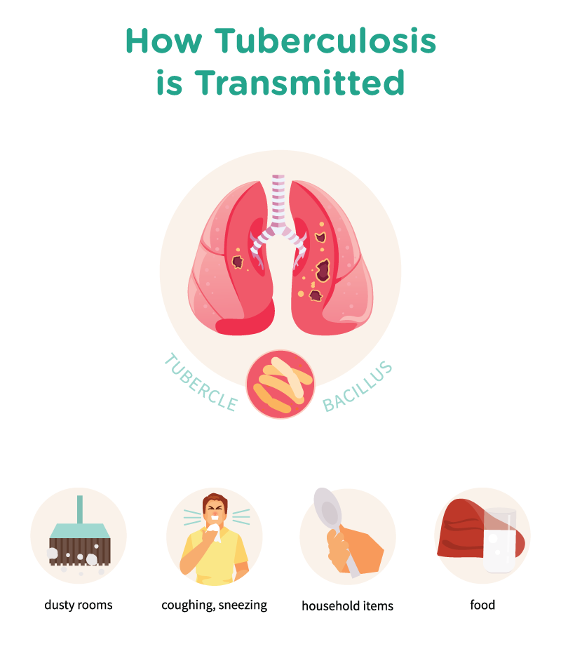 Tuberculosis Transmission